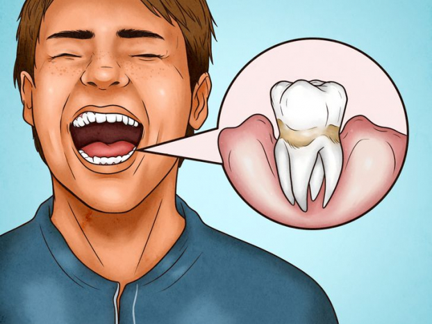 4 dấu hiệu chứng tỏ bạn đang đánh răng quá mạnh 3
