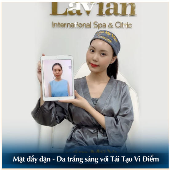 Lavian - Top đầu thẩm mỹ uy tín tại Việt Nam 3