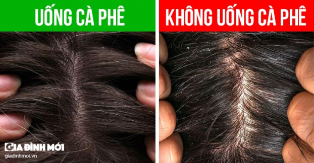 Điều gì sẽ xảy ra với mái tóc khi bạn ngừng uống cà phê? 3