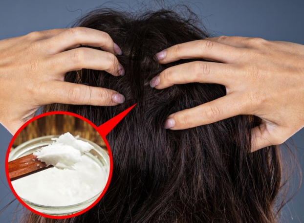 Vì sao nhiều người trẻ tóc bạc sớm và cách đảo ngược quá trình bạc tóc 3