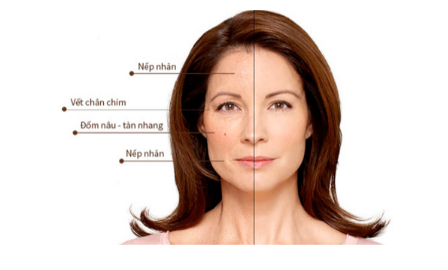 Collagen Yến sào - Khiến bạn đẹp hơn từng khoảnh khắc 0