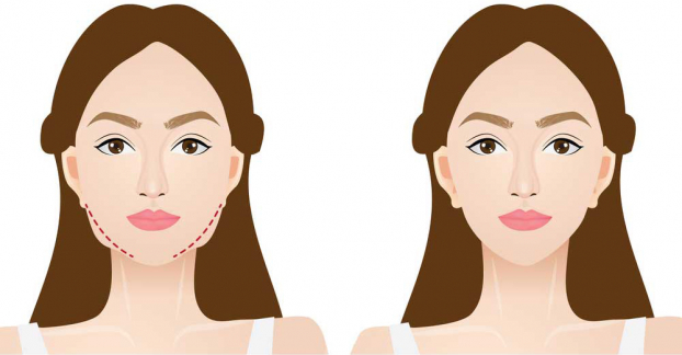 5 mẹo đơn giản giúp bạn giảm mỡ mặt không cần phẫu thuật 0