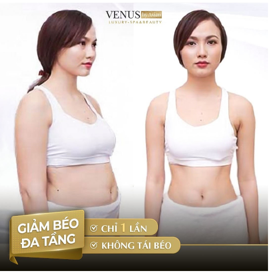 Phương pháp giảm béo mới nhất 2021: đánh bay mỡ thừa chỉ sau 1 liệu trình 4