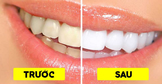 5 cách tự nhiên giúp bạn có hàm răng trắng sáng không cần đi thẩm mỹ 0