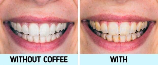 Vì sao bạn không nên uống cà phê sau bữa ăn? 2
