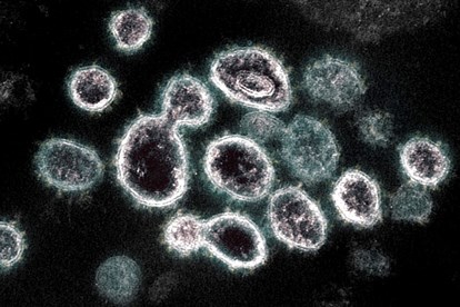   Biến chủng mới tinh của virus Sars-CoV-2 Omicron.  