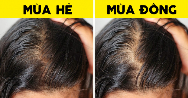 6 điều có thể xảy ra với mái tóc vào mùa đông và cách xử lý 4
