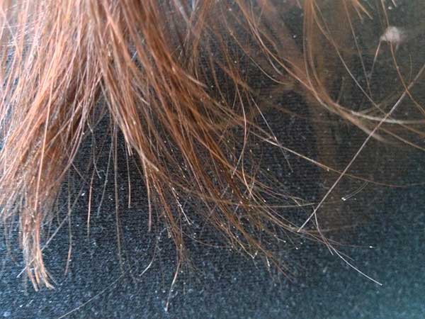 6 điều có thể xảy ra với mái tóc vào mùa đông và cách xử lý 2