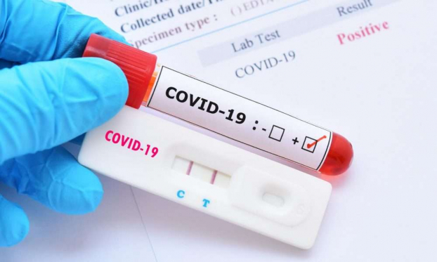   Hà Nội được dùng kết quả test nhanh xác định ca mắc COVID-19. Ảnh minh họa  