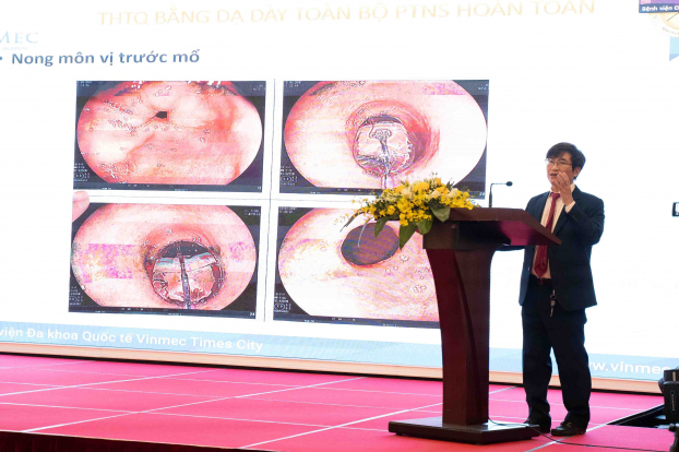   PGS. TS. Phạm Đức Huấn trình bày nghiên cứu phẫu thuật nội soi tạo hình thực quản bằng dạ dày trong UTTQ  