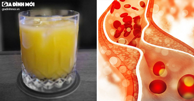 Loại đồ uống tốt hàng đầu giúp giảm cholesterol theo chuyên gia dinh dưỡng 0