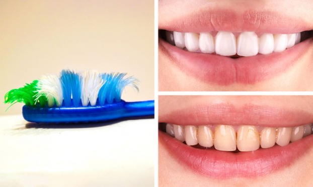 Điều gì có thể xảy ra nếu bạn đánh răng quá 2 lần/ngày? 0