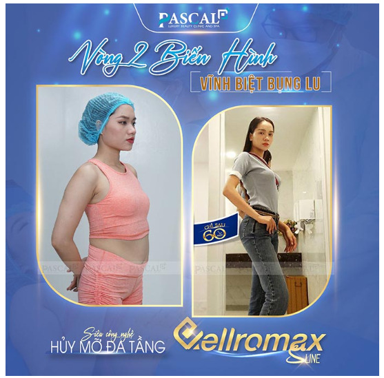   Cellromax Sline đã giúp bao cô nàng tự tin trở lại với vóc dáng thon gọn nhanh chóng, tránh tái béo hiệu quả   