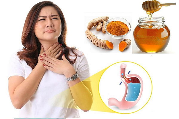 4 trường hợp không nên ăn nghệ.