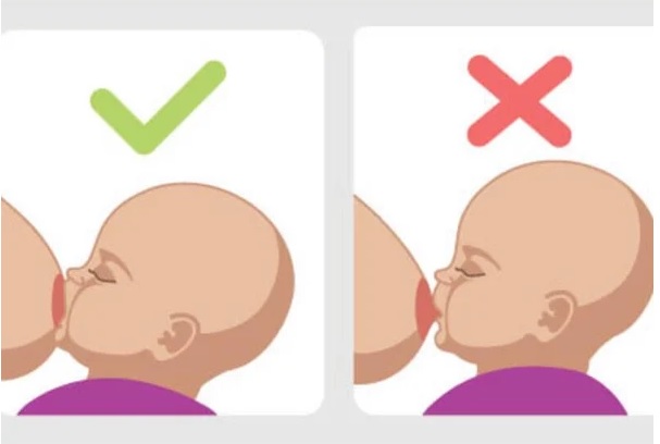 Trẻ bú mẹ sai cách có thể gây ra nhiều hậu quả không tốt cho cả mẹ và bé. Ảnh minh họa