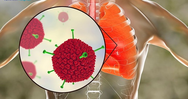 Các tổn thương thường gặp nhất do mắc Adenovirus là viêm đường hô hấp trên, viêm đường hô hấp dưới, bệnh đường tiêu hóa... Ảnh minh họa