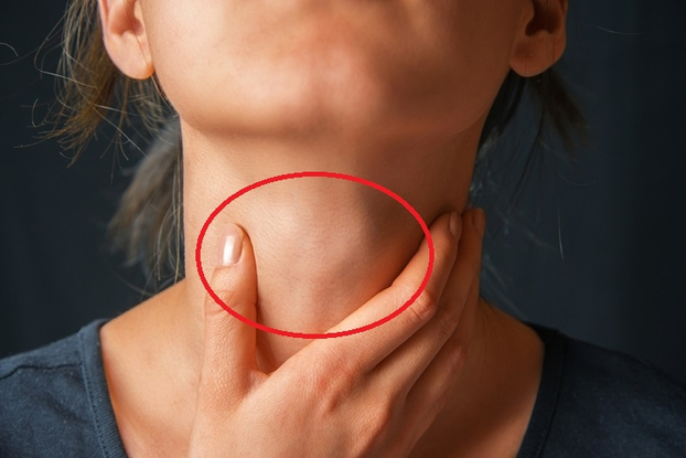 Khối u, hạch vùng cổ là những triệu chứng dễ nhận biết của bệnh ung thư tuyến giáp. Ảnh minh họa
