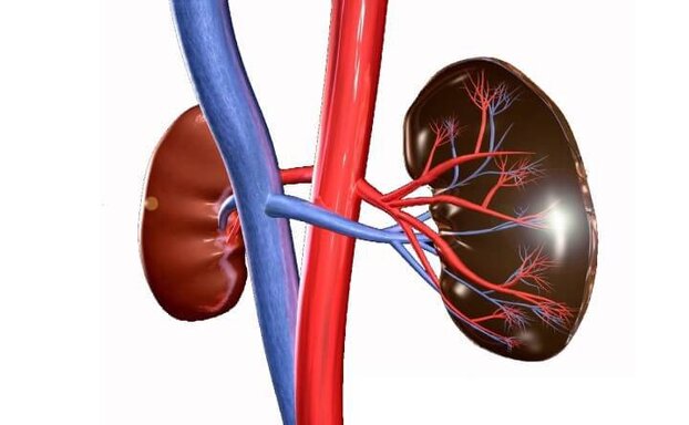 Nhồi máu thận cấp tính là tình trạng xuất hiện cục máu đông ở 1 hoặc cả 2 động mạch cung cấp máu cho thận. Ảnh minh họa