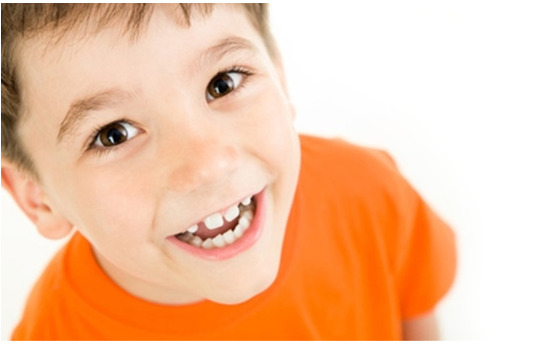 Trẻ nên niềng răng sớm nếu gặp các sai lệch như thưa, hô, móm, khấp khểnh…