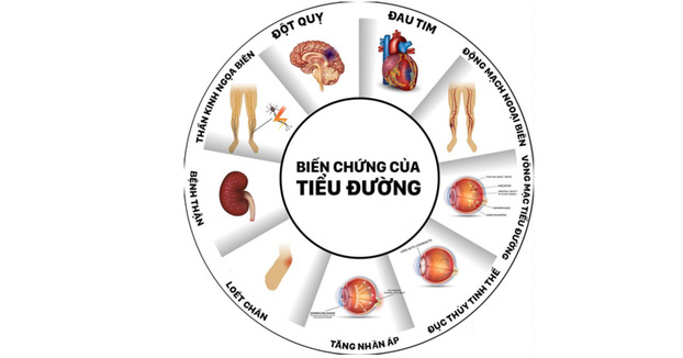 Biến chứng nguy hiểm thường gặp của đái tháo đường