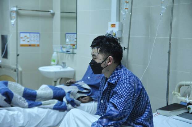 Bệnh nhân mắc bệnh thủy đậu đang được điều trị tại BV Thanh Nhàn