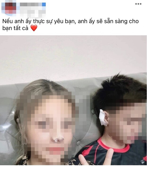 Bức ảnh với hàm ý cho bạn gái sụn tai để nâng mũi khiến nhiều người nghi ngờ về tính xác thực    