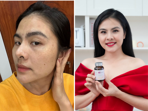 Diễn viên Vân Trang đã xoá nám, sạm thành công nhờ bộ sản phẩm của Hi Beauty.