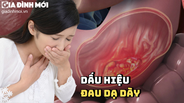 dau hieu benh symptoms dau da day