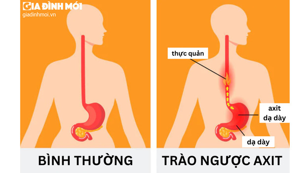 trao nguoc axit da day thuc quan o nong (1)