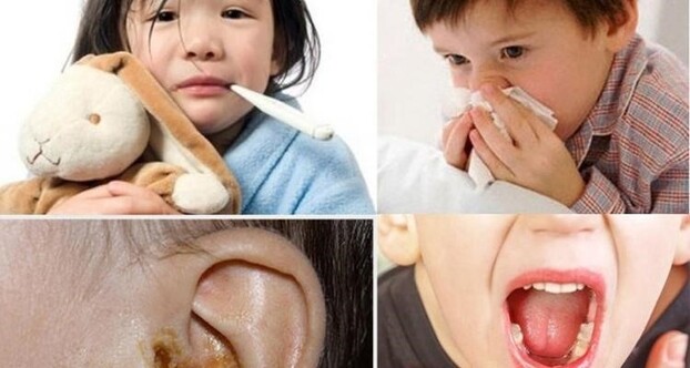 Nhiễm trùng tai mũi họng là bệnh phổ biến ở trẻ em và dễ tái đi tái lại. Ảnh minh họa