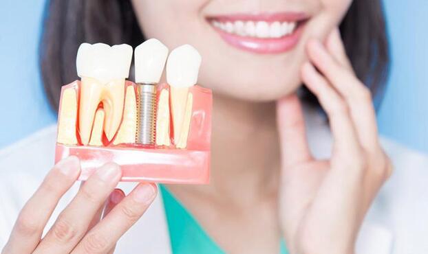 Implant là phương pháp làm răng khắc phục những nhược điểm tồn tại ở phương pháp làm răng truyền thống