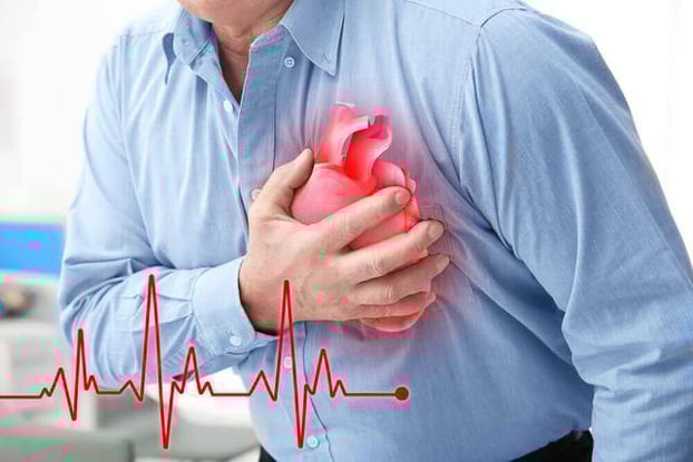 Bệnh tim mạch chiếm 33% số ca tử vong do bệnh không lây nhiễm gây ra ở nước ta hàng năm - ảnh minh họa