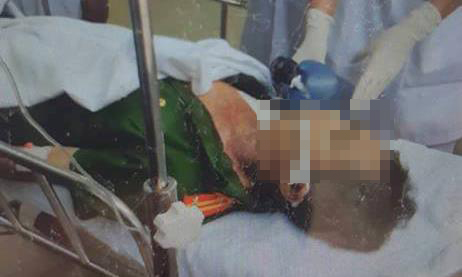Bình Thuận: Bắt kẻ ngáo đá, Trưởng công an xã bị đâm tử vong 2