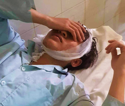 Lâm Đồng: Hỗn chiến tại quán cà phê, 6 thanh niên bị chém trọng thương 2
