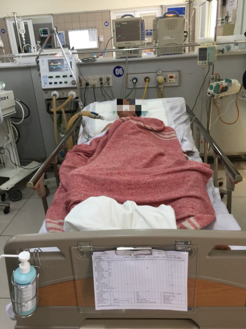 bệnh nhân Ngô Văn H. nhập viện vì ngạt khí CO2