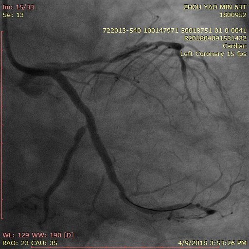 Hình ảnh cơ tim của bệnh nhân M.