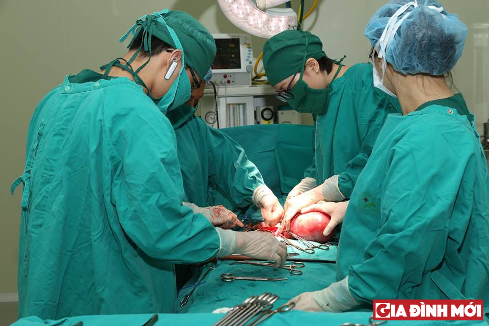 Kíp phẫu thuật cho bệnh nhân có khối u xơ tử cung khủng
