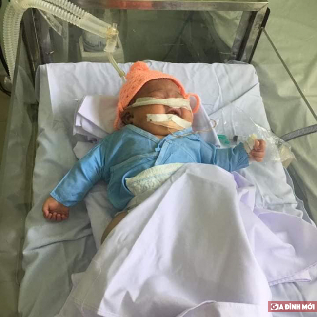 Bé sơ sinh gãy tay, nguy kịch sau khi sinh tại Bệnh viện huyện 1