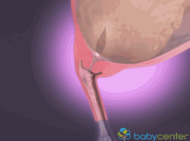 Hình ảnh 3D mô phỏng quá trình sinh nở mẹ bầu xem sẽ không còn lo lắng 5