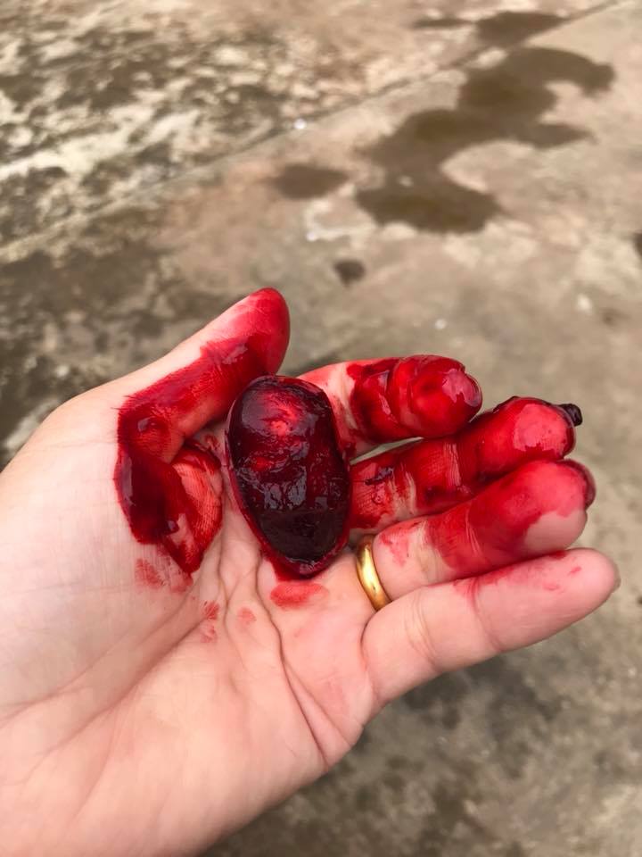 Bóp quả máu sẽ thấy dịch chảy ra màu đỏ đậm, đặc sánh như máu - Ảnh: Giangnhu Nguyen/Facebook.