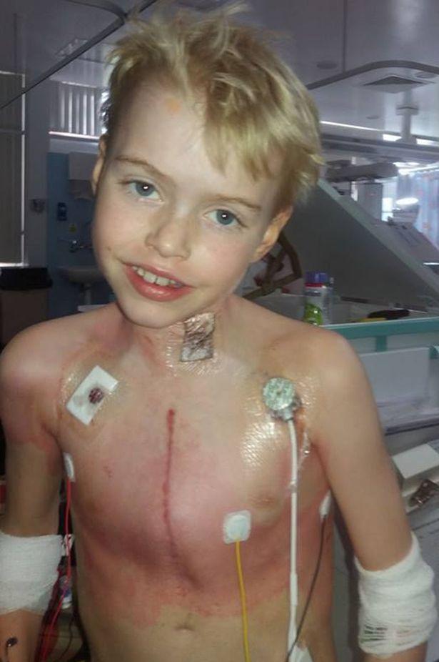   Cậu bé Max Johnson khỏe mạnh sau cuộc phẫu thuật ghép tim thành công  