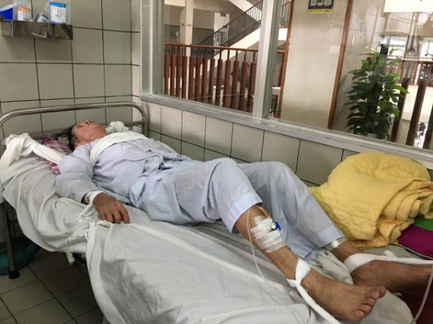   Một bệnh nhân xơ gan do rượu bị sảng rượu phải trói chân tay trên giường bệnh tại khoa Tiêu hóa, BV Bạch Mai (Ảnh tư liệu: HQ)  