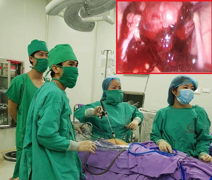 Bác sĩ tiến hành phẫu thuật cho bệnh nhân Nguyễn Thị Trần L. mang thai ngoài tử cung bị vỡ