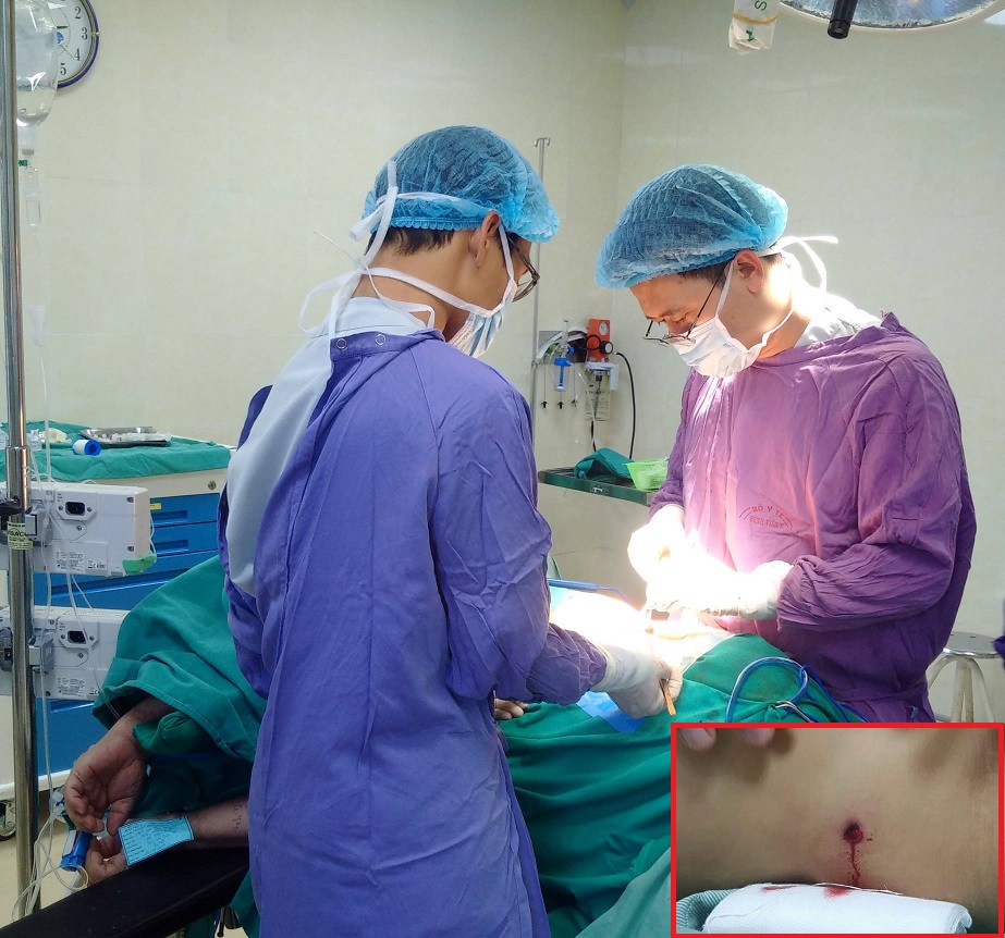 Bác sĩ tiến hành mổ cấp cứu cho nữ bệnh nhân bị đạn lạc bắn thủng bụng