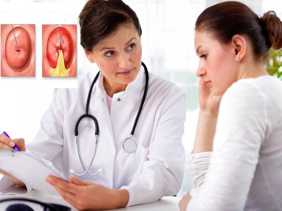 Viêm lộ tuyến cổ tử cung chỉ có thể phát hiện khi đi khám phụ khoa