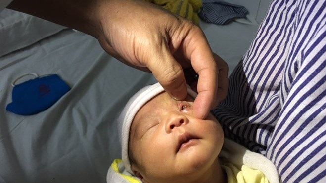 Nhỏ sữa mẹ vào mắt trẻ sẽ làm cho tình trạng viêm nhiễm ở mắt trở nên trầm trọng hơn