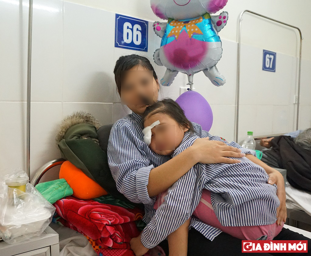 Bé N.T.A.D. (5 tuổi, ở Lương Tài, Bắc Ninh) nhập viện đến nay đã được một tuần với tổn thương rất nghiêm trọng ở mắt