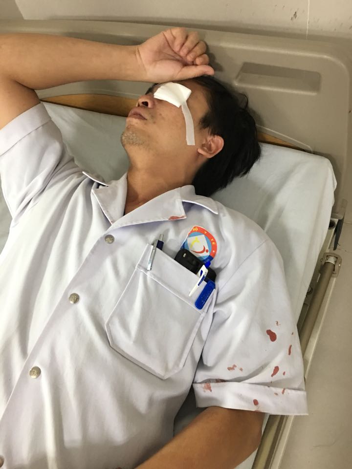 Bác sĩ Trần Văn Sơn - Bệnh viện Việt Nam Cu Ba Đồng Hới, Quảng Bình đang nằm cấp cứu tại bệnh viện sau khi bị người nhà bệnh nhân tấn công tối 23/10/2017. Ảnh báo SKĐS