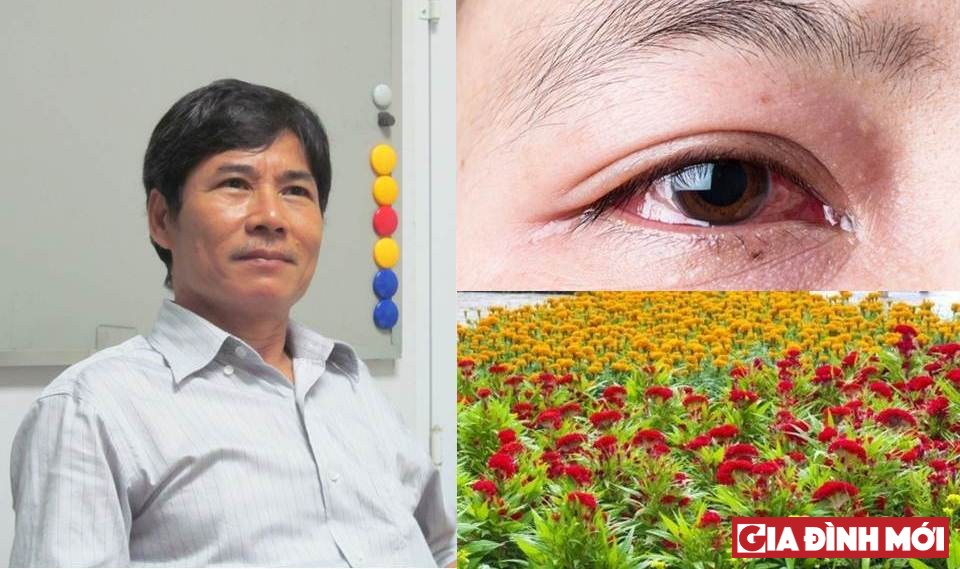 PGS.TS Nguyễn Văn Đoàn, Nguyên Giám đốc Trung tâm Dị ứng Miễn dịch Lâm sàng, Bệnh viện Bạch Mai cho biết: 