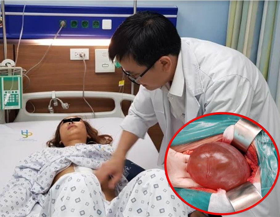 Bệnh nhân Nguyễn Thị Thu H. (19 tuổi) bị bệnh hiếm gặp u xơ tơ huyết thanh dịch được các bác sĩ Bệnh viện Đa khoa Xanh Pôn phẫu thuật điều trị thành công